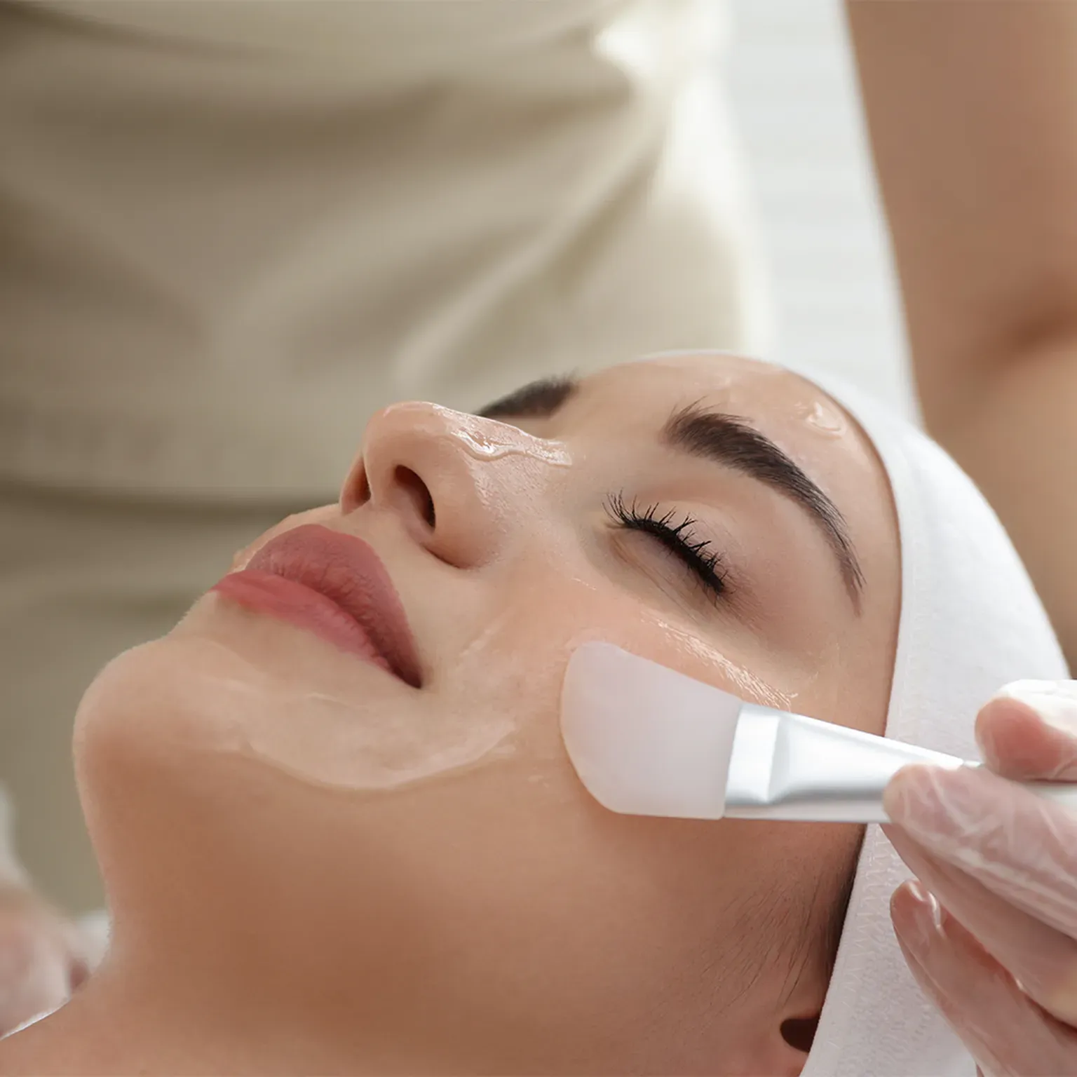 Chemical Peel